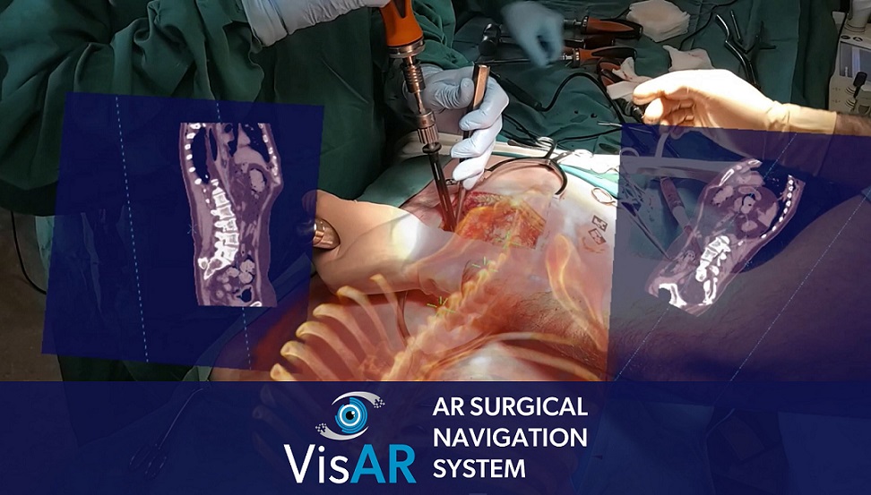 First Fully Immersive 3D Augmented Reality Surgical Navigation System Achieves FDA Approval For Precision Spine Surgery - Ortho Spine News