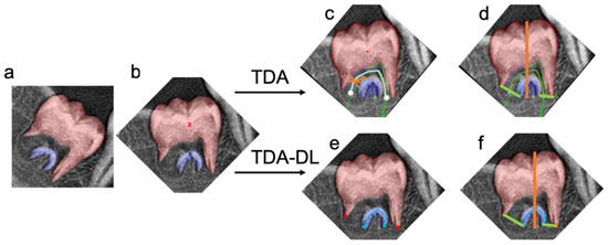 IJERPH | Free Full-Text | Artificial Intelligence as a Decision-Making Tool in Forensic Dentistry: A Pilot Study with I3M