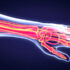 Artificial intelligence as good as other methods for documenting hand surgery cases